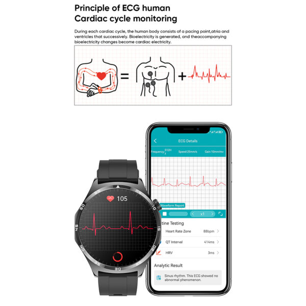MT300 Smart Watches for Men Women Waterproof Smartwatch ECG Blood Glucose Monitoring